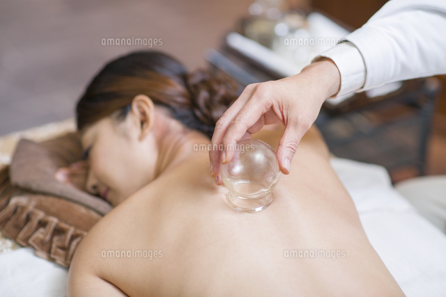 young woman receiving vacuum cupping treatment 11091018186 写真